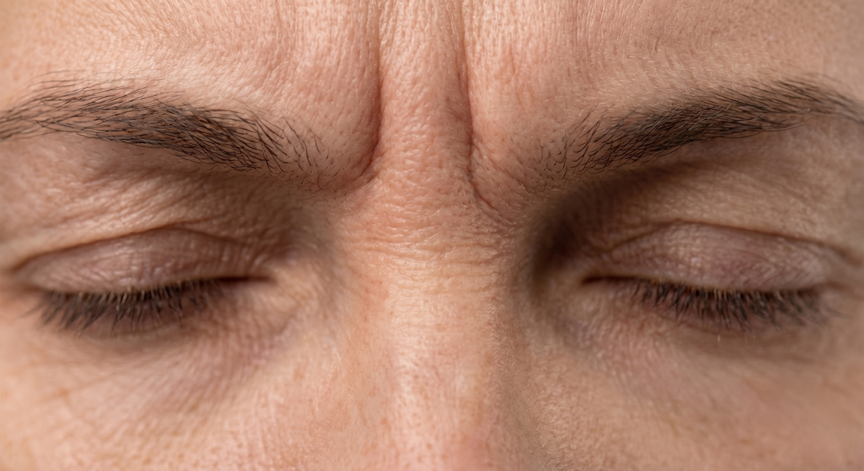 Frown Lines